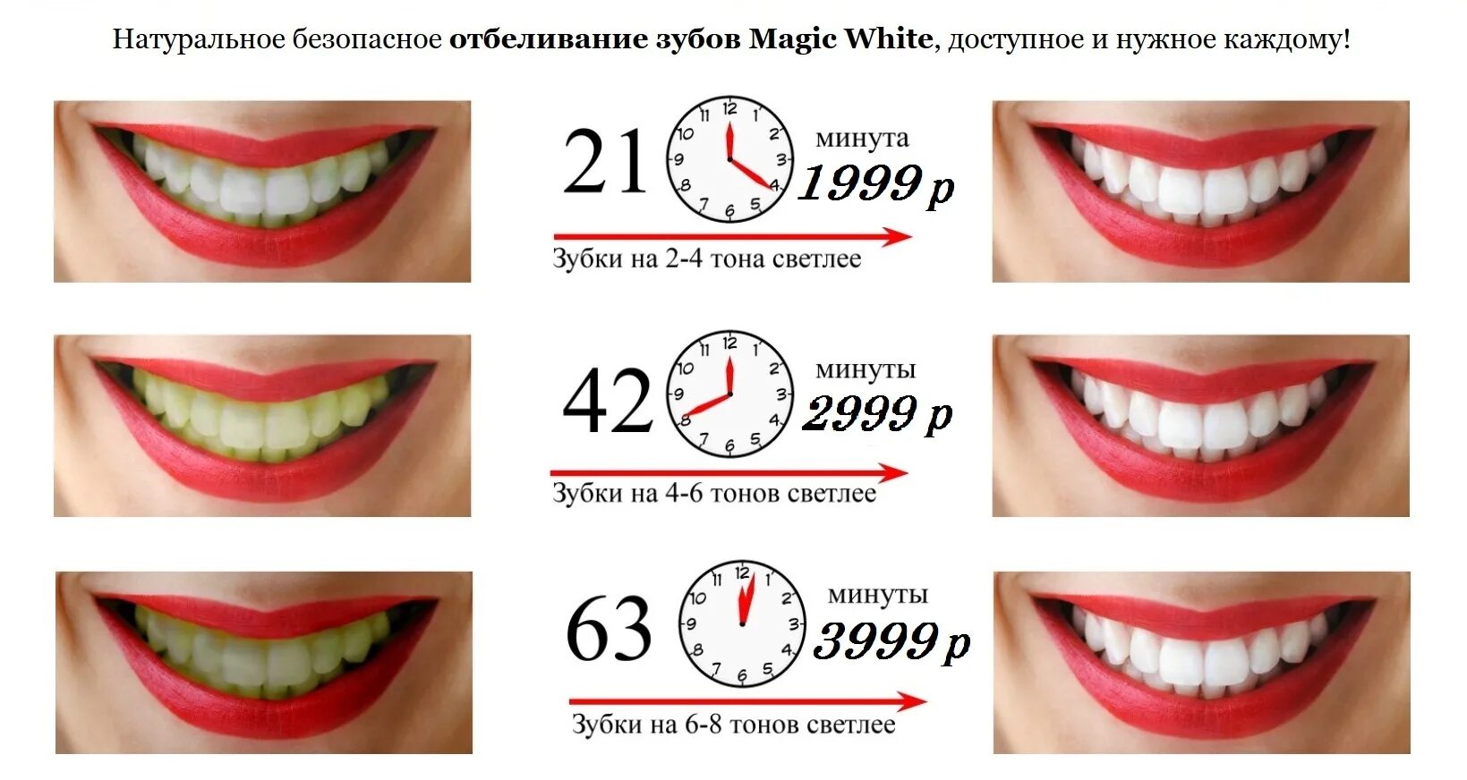 Сколько по времени делают зубы. Отбеливание зубов. Косметическое отбеливание зубов. Диета после отбеливания зубов. Визитка отбеливание зубов.