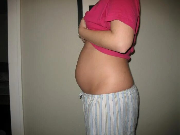 7 недель беременности месячные