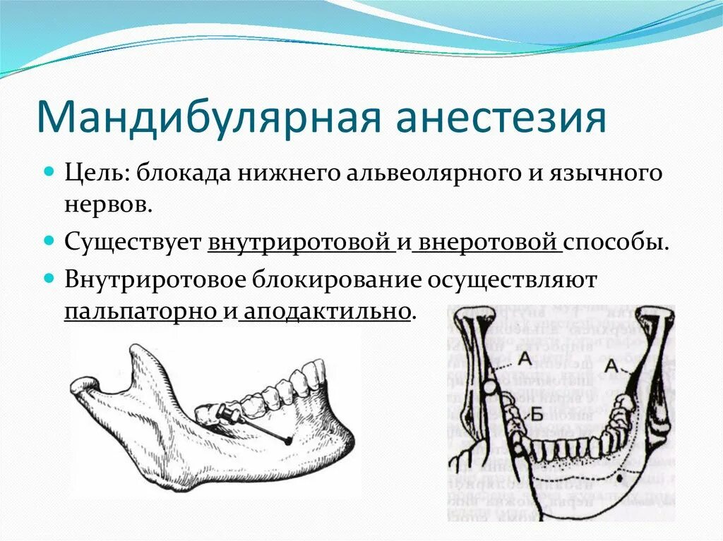 Проводниковая анестезия нижней челюсти торусальная. Метод проведения мандибулярной анестезии. Мандибулярная анестезия нижней челюсти. Мандибулярная анестезия крыловидно нижнечелюстная складка. Проведение проводниковой анестезии