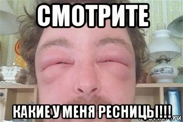 Отекаю утром форум