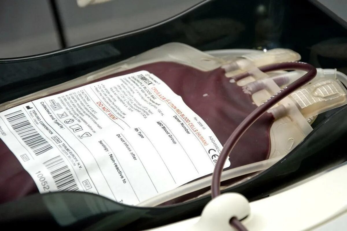 Донорство вологда. Скрининг донорской крови. Универсальная кровь для донорства. Больному переливают кровь.