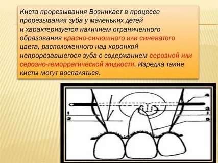 Лечение кист у ребенка