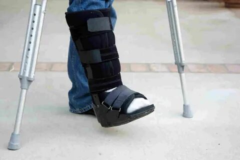 Sprained leg