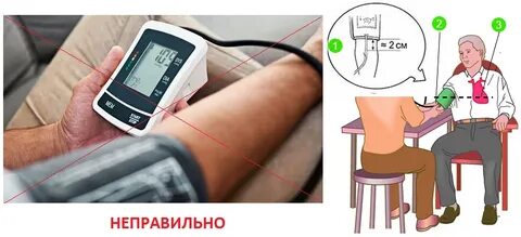 Мерят ли давление на ногах