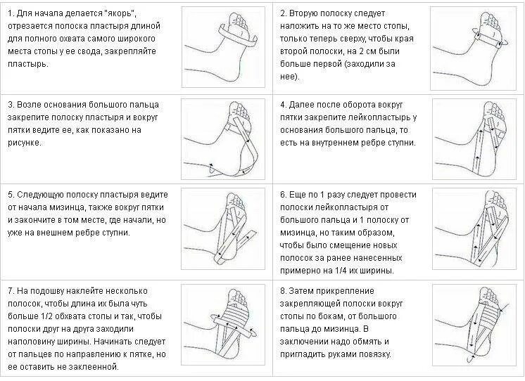 Шпоры причина появления. Лечебная гимнастика при пяточной шпоре. Упражнения при подошвенном фасците. Пяточная шпора лечебная гимнастика. Упражнения для пяточной шпоры.