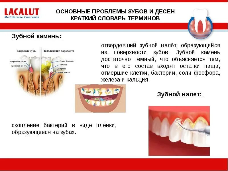 Состав десны