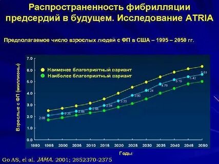 Фибрилляция предсердий у взрослых