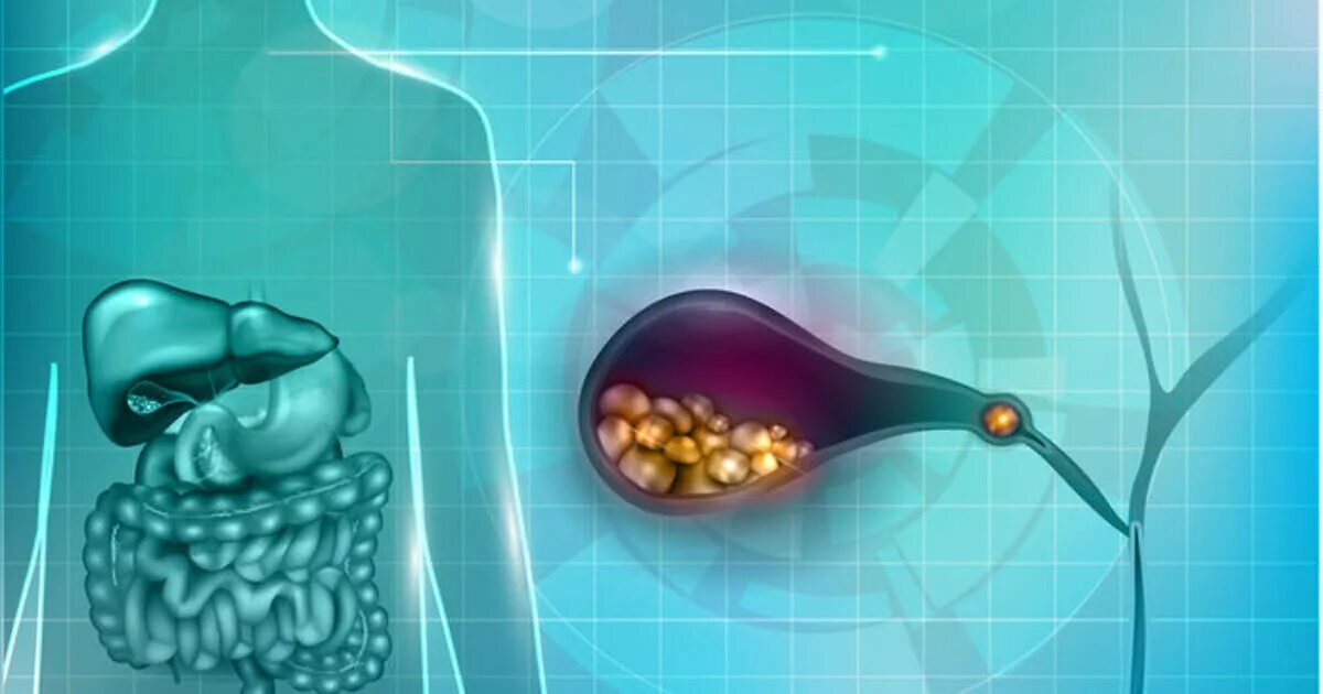 Здоровый желчный пузырь. Желчнокаменная болезнь.