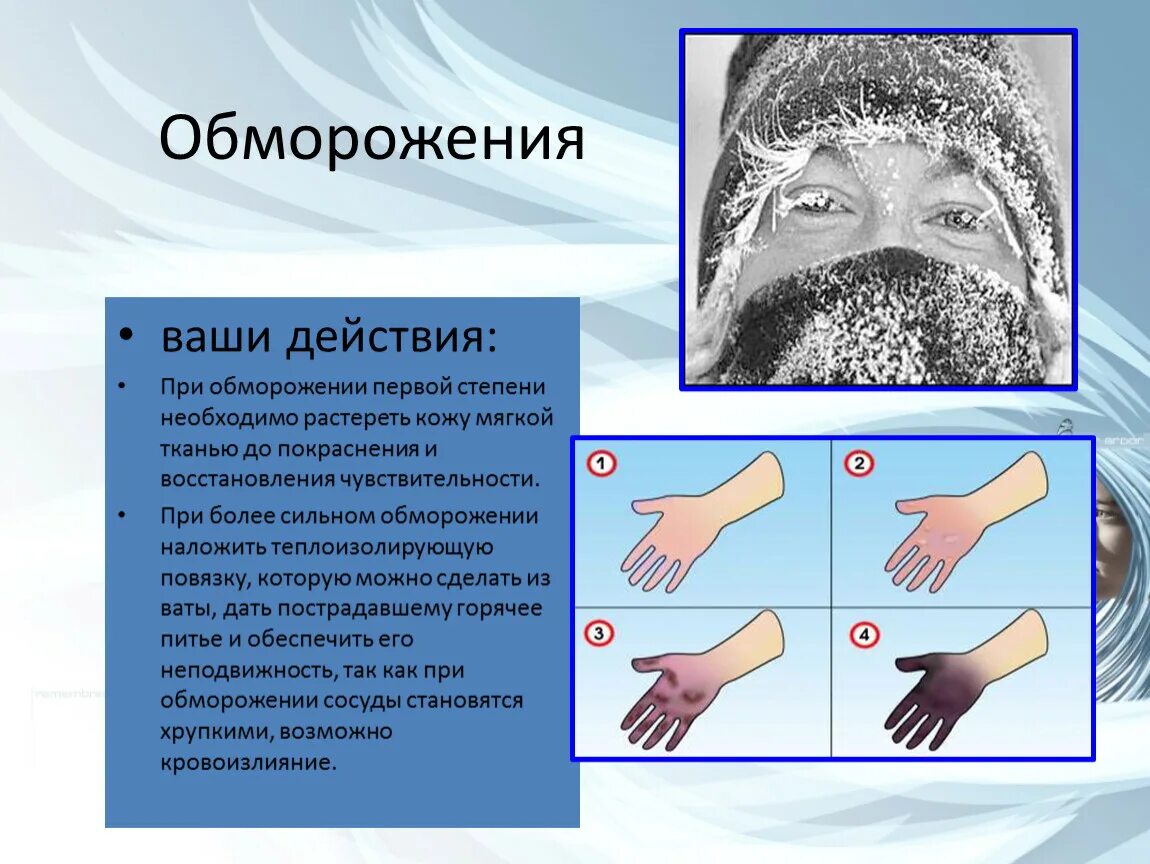 Степени обморожения кожи. Обмороженные участки кожи. Травмы кожи обморожение.