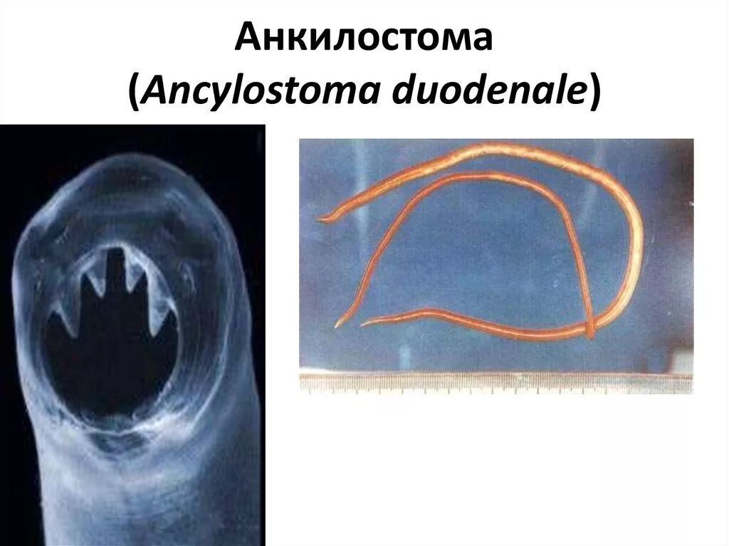 Анкилостома дуоденале. Анкилостомоз у кошек. Анкилостома у собак фото. Анкилостомоз и унцинариоз плотоядных. Анкилостомоз у кошек.