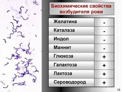 Возбудитель рожи
