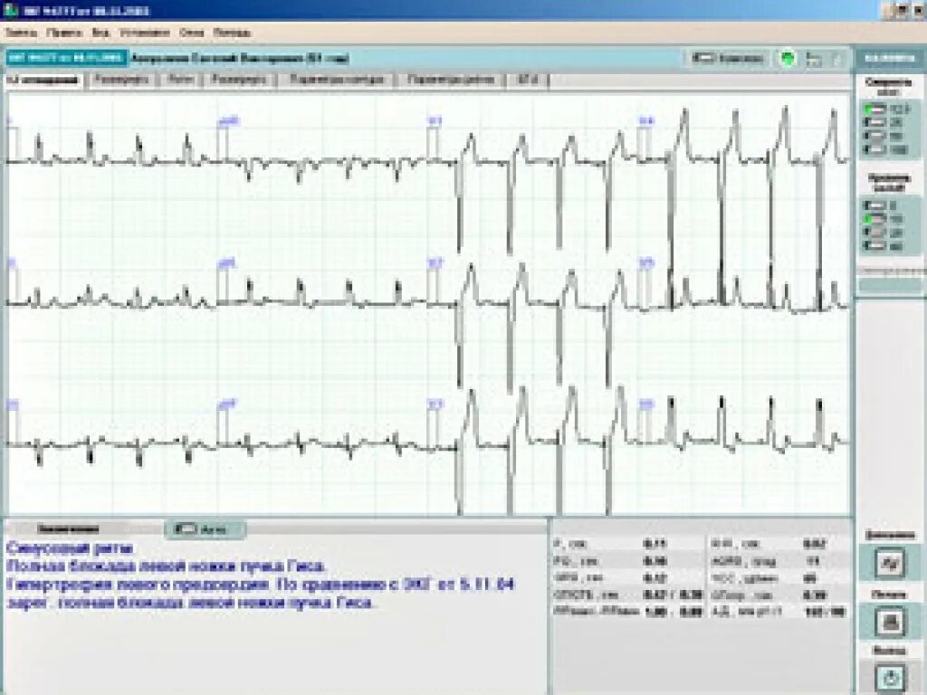 комплексы функциональной диагностики. метаболограф cosmed quark. стресс системы(тредмил. реограф-полианализатор ргпа-6/12 «реан-поли». система тредмил ge advantech cardiosoft v6.