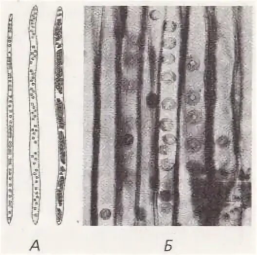Трахеиды под микроскопом. Трахеиды вытянутые клетки. Трахеиды сосны. Трахеи и трахеиды растения. Сильно вытянутые клетки
