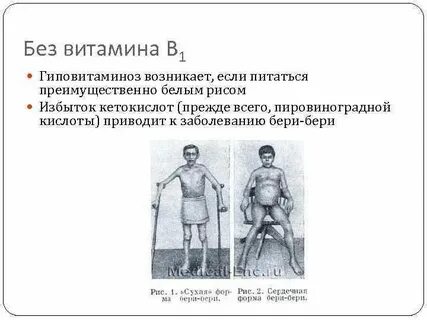 Бери бери недостаток какого