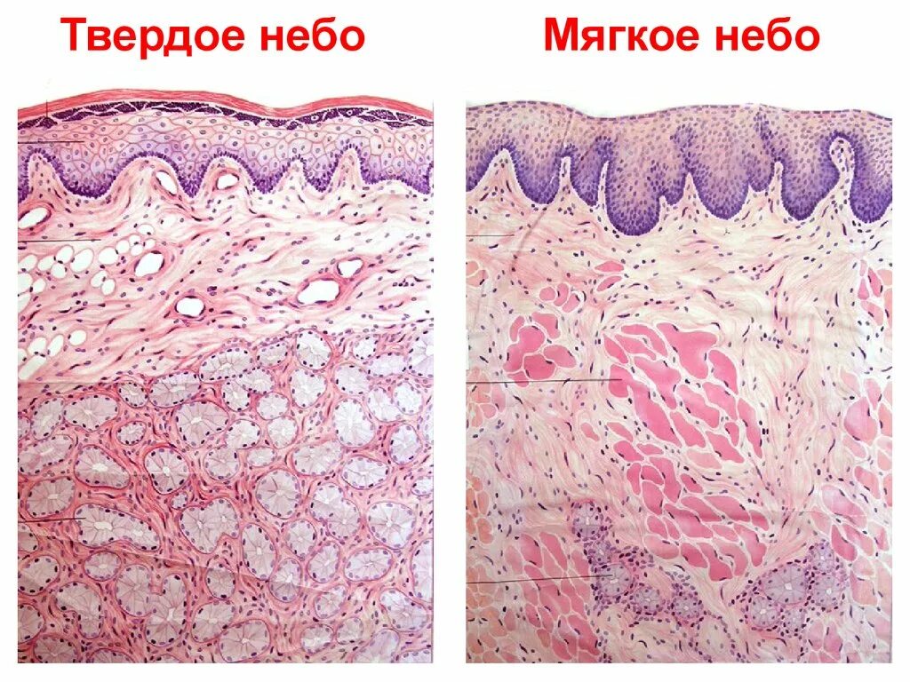 Гистология рта. Твердое небо гистология препарат. мягкое небо гистология препарат. препарат твердого неба гистологический. слизистая оболочка твердого неба гистология.