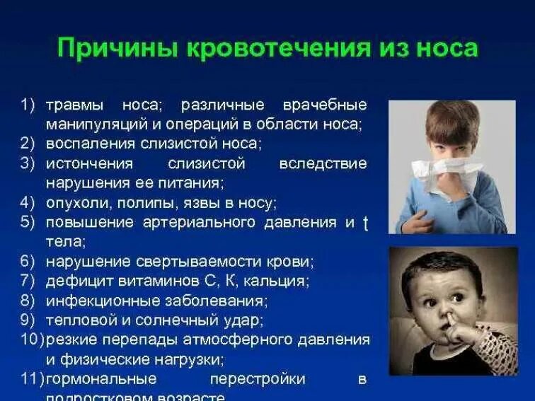 Носовое кровотечение 10 лет. Носовые кровотечения у детей причины. Идёт кровь из носа причины. Причины кровотечения из носа у детей. Кровь из носа у ребенка причины.