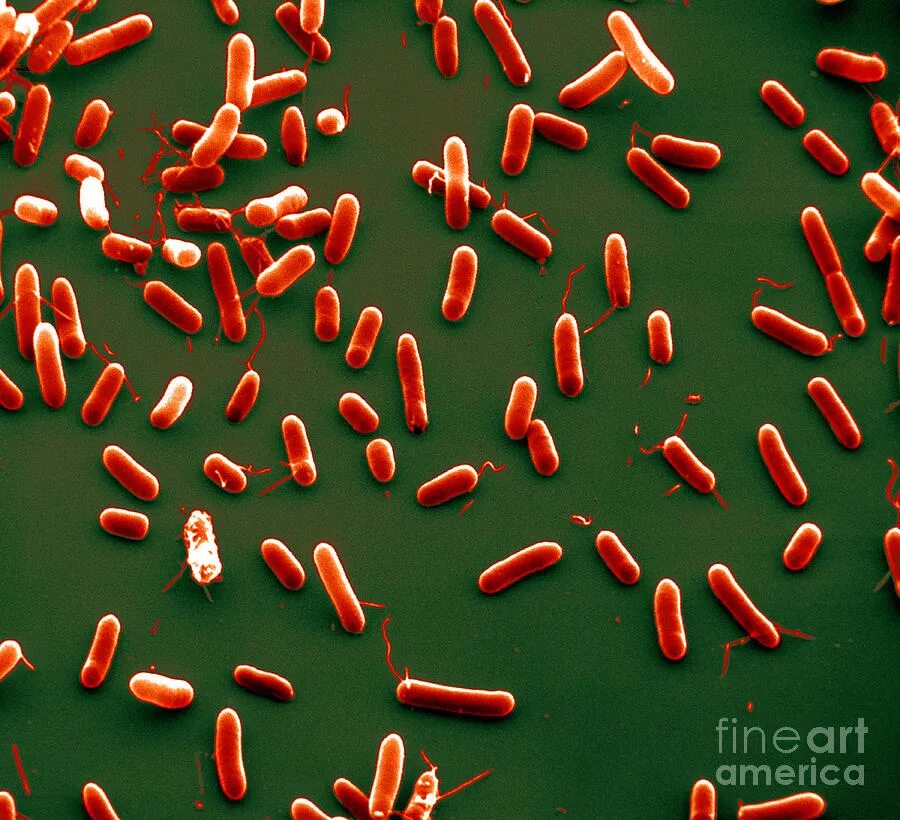 Haemophilus в мазке у мужчин. Бактерии Haemophilus influenzae. Haemophilus SPP возбудитель. Гемофилус инфлюэнце.