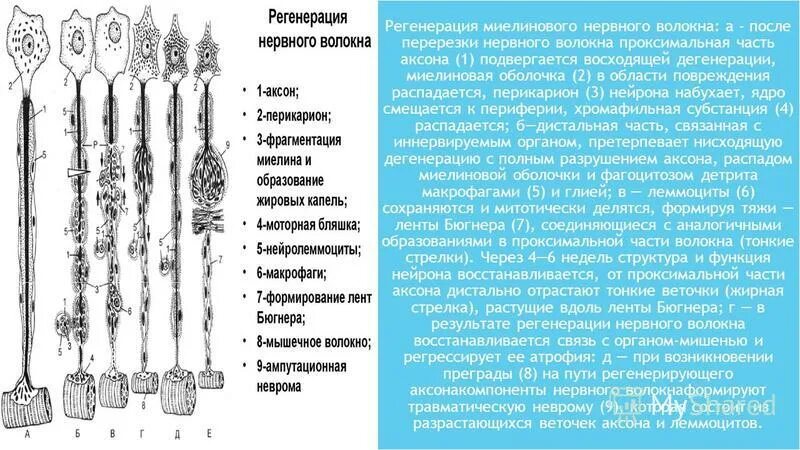 3. Регенерация нервных волокон в цнс и пнс. Регенерация нервного волокна схема. Схема регенерации нейрона после повреждения его отростка. Регенерация периферического нерва.