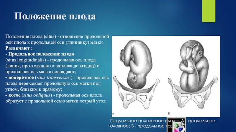 Продольное положение плода. Положение плода продольное головное. Тазовое продольное положение плода. Положение плода продольное предлежание головное. Положение плода в матке продольное