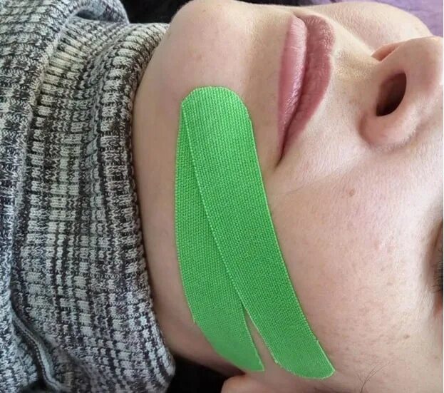 Тейпирование для подтяжки. Носогубка в тейпирование. тейпирование птоза. тейпирование для подтяжки овала лица. тейпы на подбородок.