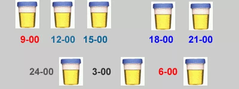 Контейнеры для сбора мочи по Зимницкому. Проба Зимницкого исследование мочи. Правило сбора мочи по Зимницкому. Посуда для сбора мочи по Зимницкому название оборудования.
