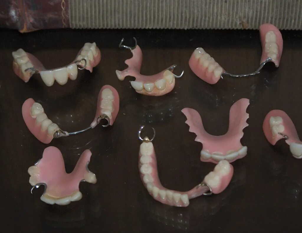 Снимать ли зубные протезы на ночь. Протезы зубов на присосках. Зубные протезы на присосках.
