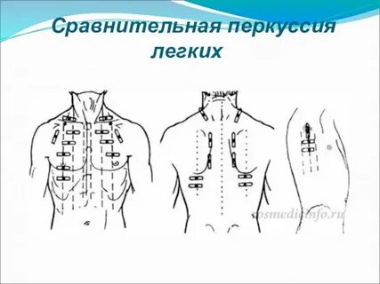 Перкуссия органов дыхания