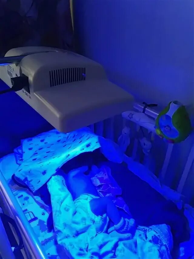 Сколько нужно лежать под лампой при желтухе
