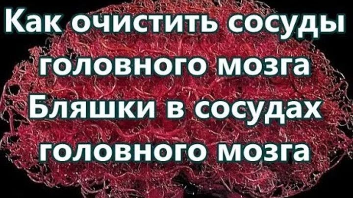 Очистка сосудов головы. Чистим сосуды головного мозга. Как чистить сосуды головного мозга. Как очистить сосуд мозга. Как,чистить,сосуды,голова,.