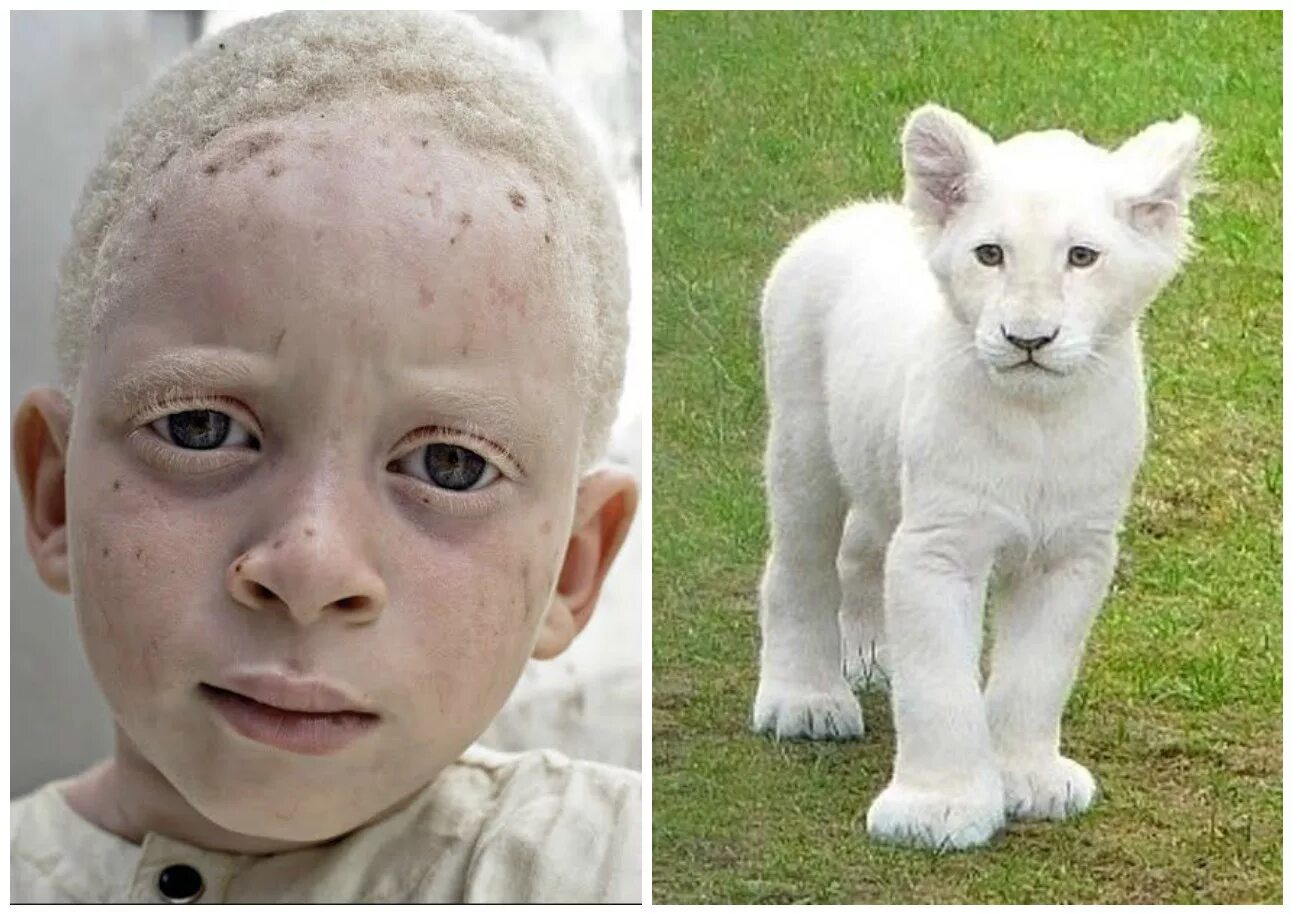 Правда что люди животные. Генные болезни альбинизм. Альбинизм это геномная мутация. Альбинизм генная мутация.