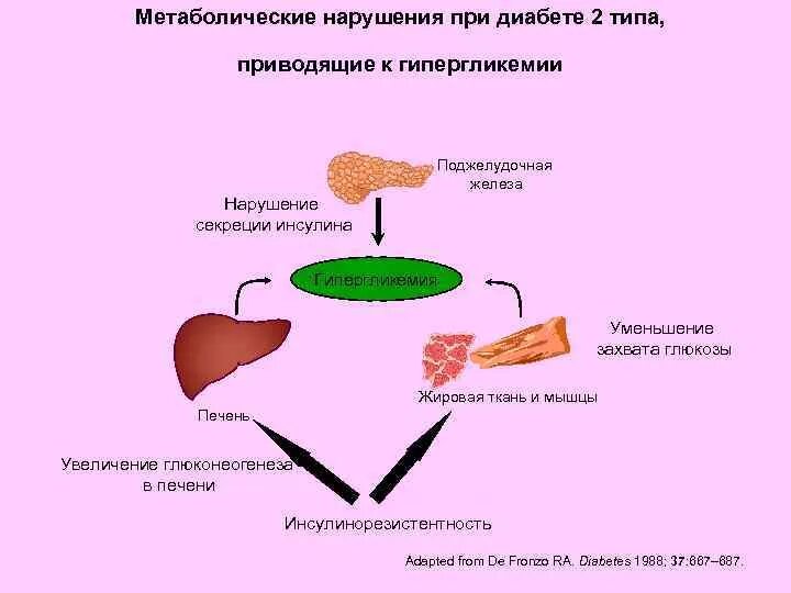 Диабет пересадка поджелудочной железы. Поджелудочная железа с диабетом 2 типа. Поджелудочная при сахарном диабете 2 типа. Поджелудочная железа инсулин 2 типа. Препарат поджелудочной железы при СД 2 типа.