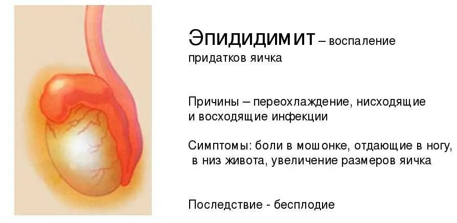 Лечение боли яичек у мужчин