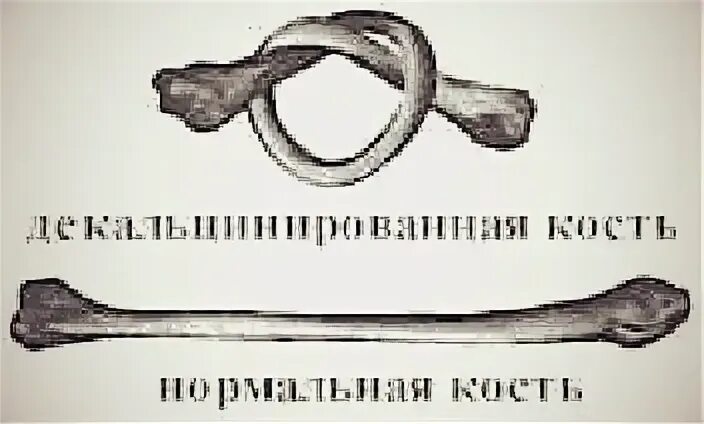 Эксперимент костями