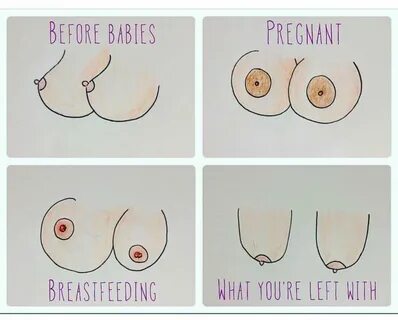 What Happens to Your Breasts During and After Pregnancy? 