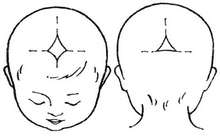 Почему пульсирует родничок. Большой и малый Родничок у новорожденного. Большой Родничок и малый Родничок у новорожденного. Большой Родничок у новорожденного. Сосцевидный Родничок у новорожденных.
