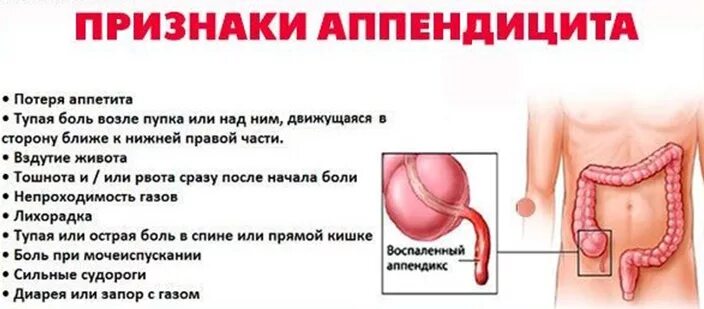 Боль в спине слева ниже поясницы. Болит место возле. Болит место возле. Болит место возле. Острый холецистит иррадиация болей.