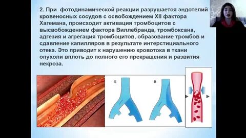 Фотодинамическая терапия шейки
