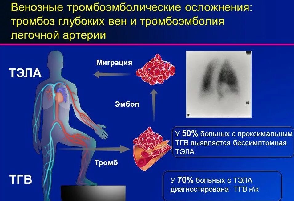 Тромбоз артерий лечение. Тэла этиология и причины. Заболевания вен нижних конечностей Тэла. Венозные тромбозы и тромбоэмболия лёгочной артерии клиника. Постинъекционные осложнения венозные тромбозы.