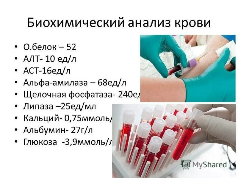 Анализ крови. Биохимическое исследование крови. Клиническое исследование крови. Общий анализ крови анализ крови. Биохимические пробы