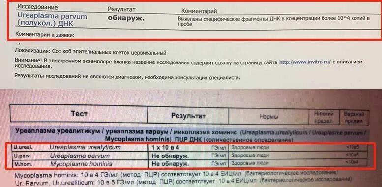 Ureaplasma parvum у мужчин что это. Уреаплазма уреалитикум нормы показателей. ДНК Ureaplasma (u.urealyticum, u.parvum) (количественное исследование). ПЦР уреаплазма SPP количественно. Уреаплазма уреалитикум и парвум.