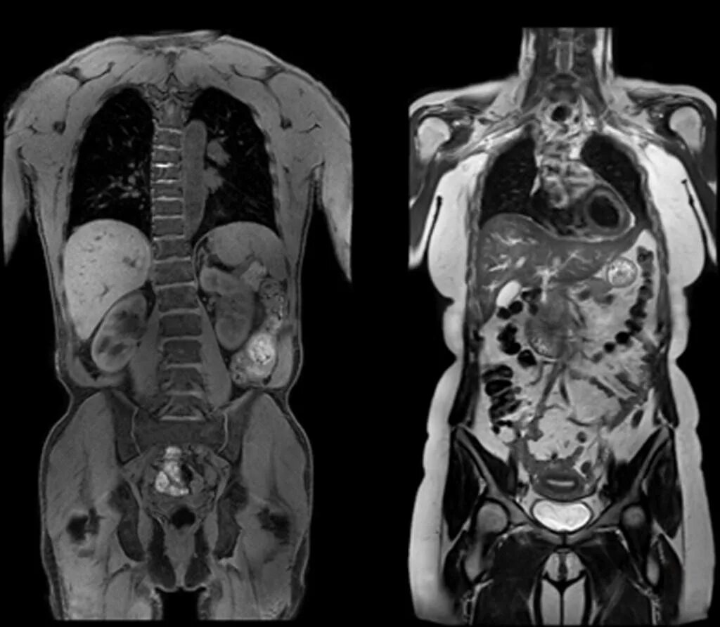 Узи полные органов. Снимок брюшной полости МСКТ. Мрт кт рентген.