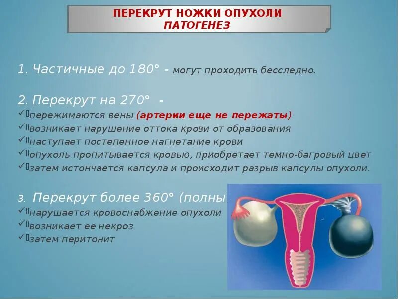 Какие гормоны после удаления матки. Перекрут кисты яичников. Перекрут ножки кисты яичника. Перекрут кисты яичника классификация. Перекрут ножки опухоли яичника.