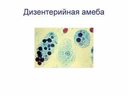С помощью какого процесса дизентерийная