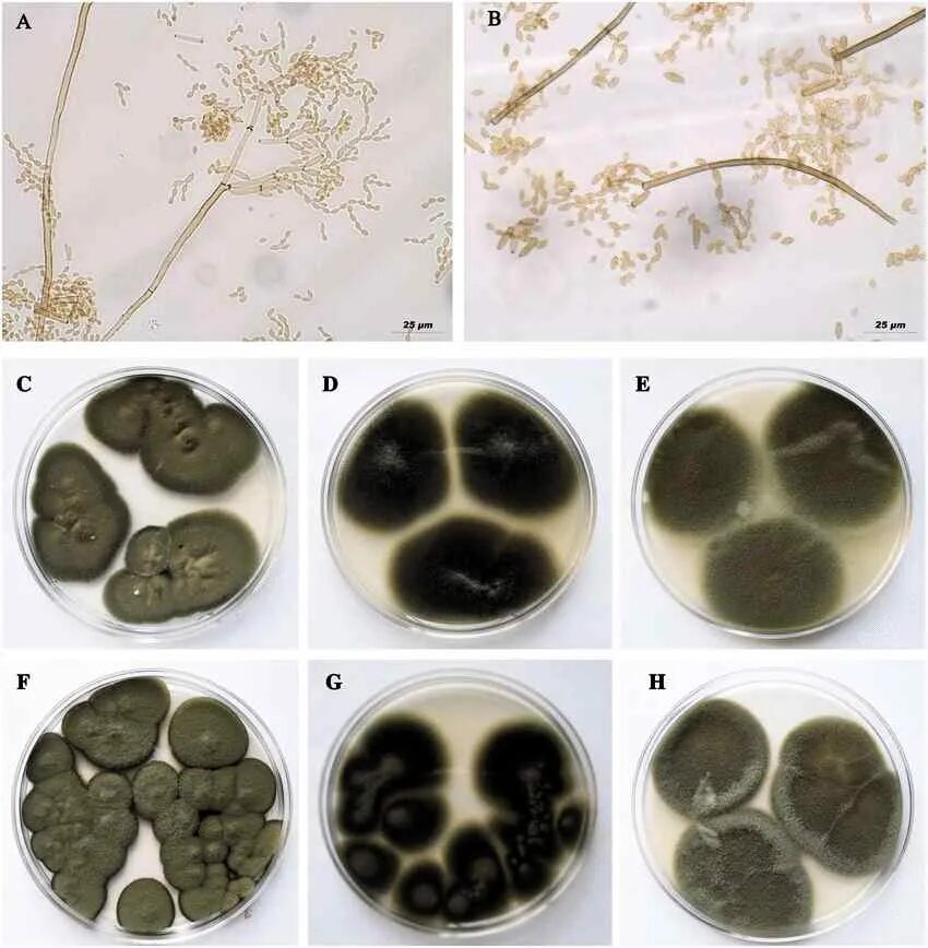 Плесень на семенах. Cladosporium werneckii морфология. Плесень Cladosporium. Cladosporium herbarum. Гриб Cladosporium herbarum.