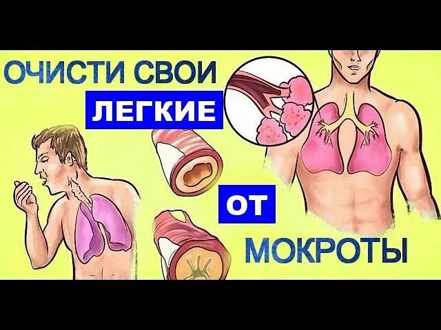 Выведение мокроты из легких. Очистить легкие от мокроты. Очистить лёгкие от макроты. Средство от слизи и мокроты. Очистка бронхов и легких от мокроты.