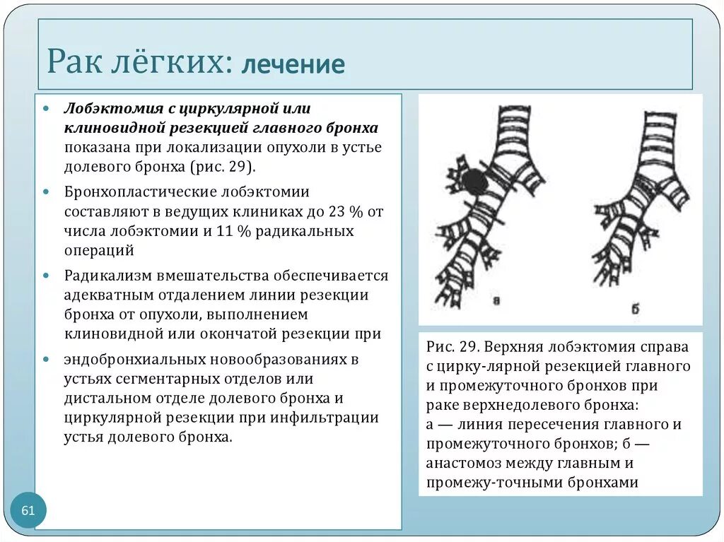 Сколько лечится рак. Клиновидная резекцией главного бронха. Опухоль главного бронха. Резекция промежуточного бронха. Циркулярная резекция бронха.