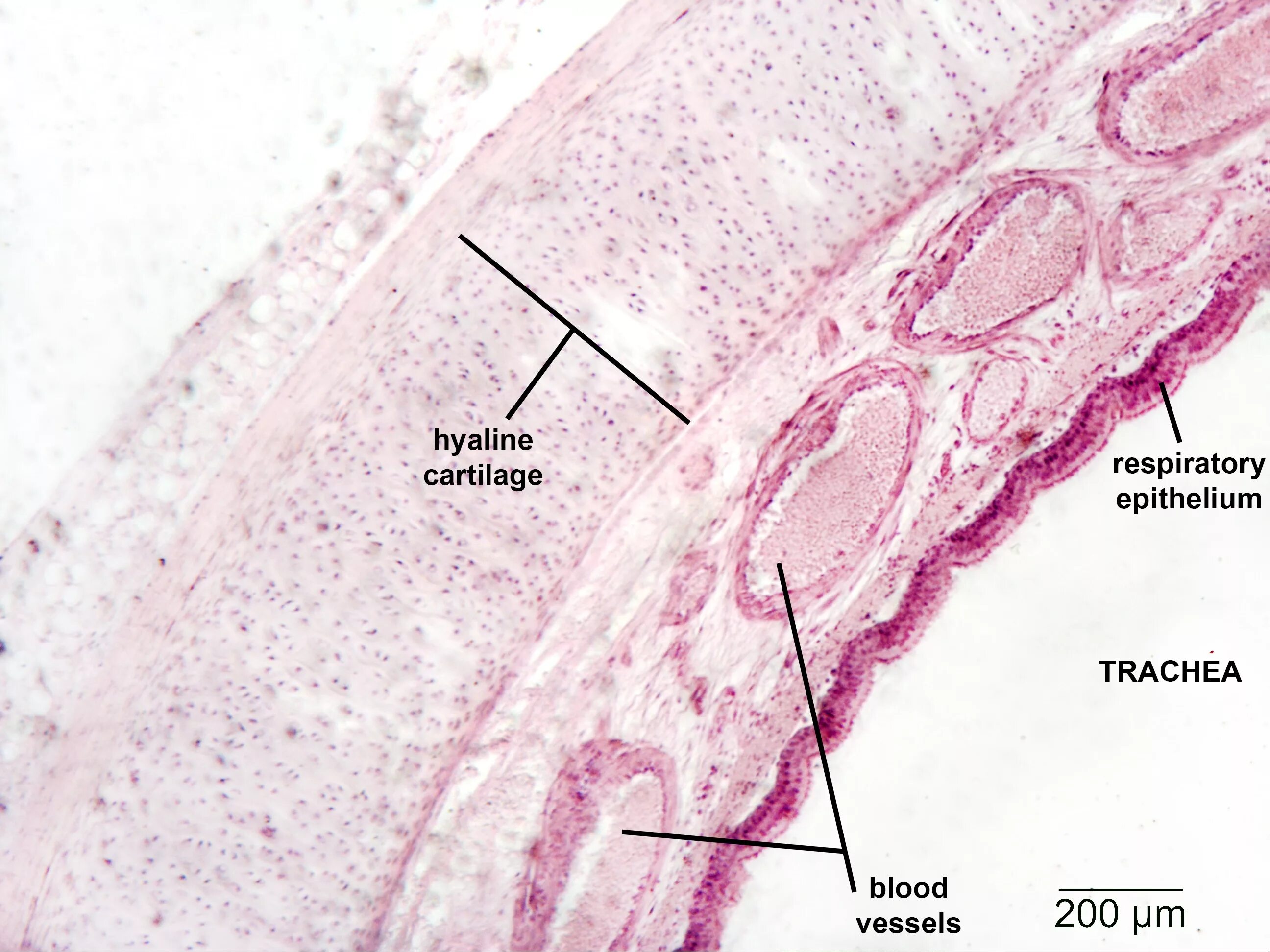 Трахея гистология препарат. Трахея поперечный срез гистология. Срез трахеи гистология препарат. Строение трахеи гистология.