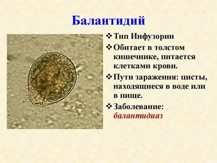 Балантидиаз это