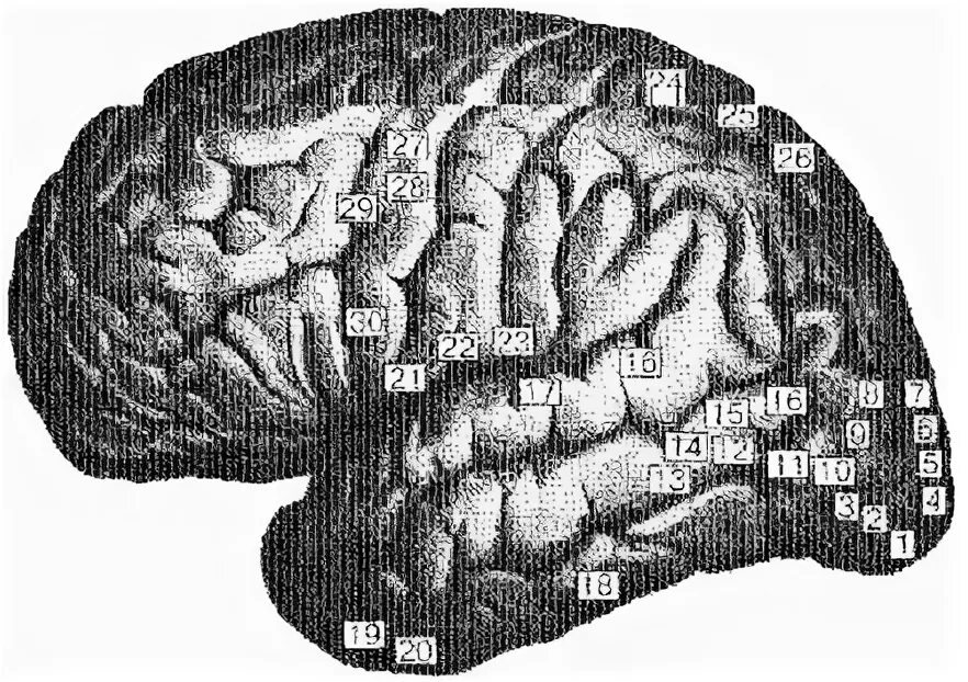 Рассмотрите рисунок с изображением мозга человека. Анатомо-морфологическая база высших психических функций. Оптико-мнестическая афазия. Афазии и зоны мозга. Оптико-мнестическая афазия локализация.