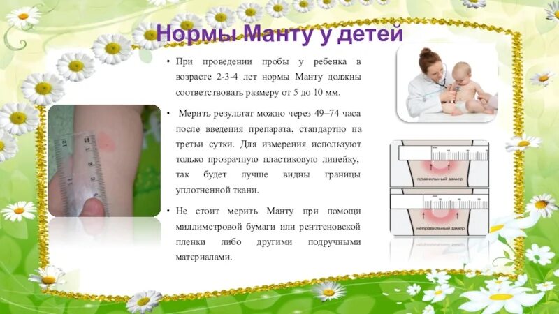 Реакция манту размеры норма у детей. Реакция манту норма у детей 4 года. реакция манту норма у детей 3 года. манту норма для детей 2 -3 года.